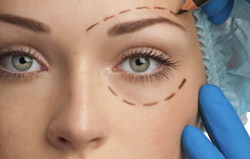 upper-eyelid-blepharoplasty